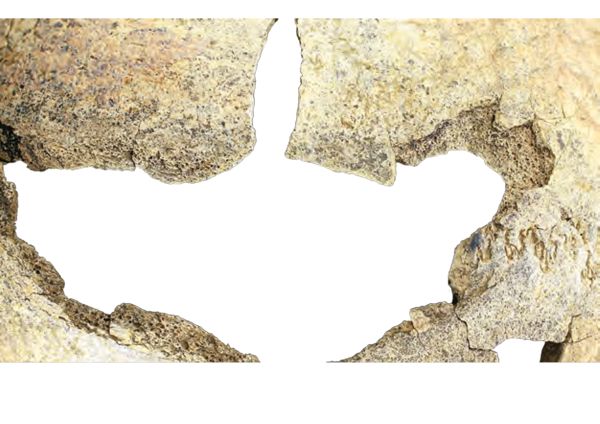 Superior view of the craniofacial block with fracture and black spot. © J.-H. Yvinec, Inrap 2013. 